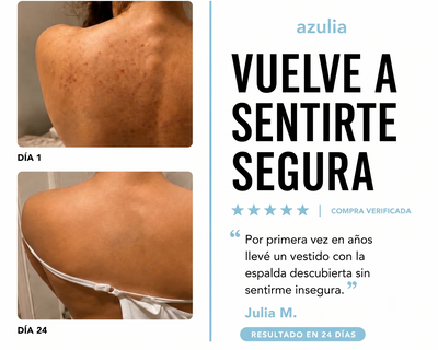 Jabón antiacné Azulia™