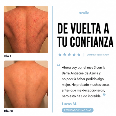 Jabón antiacné Azulia™