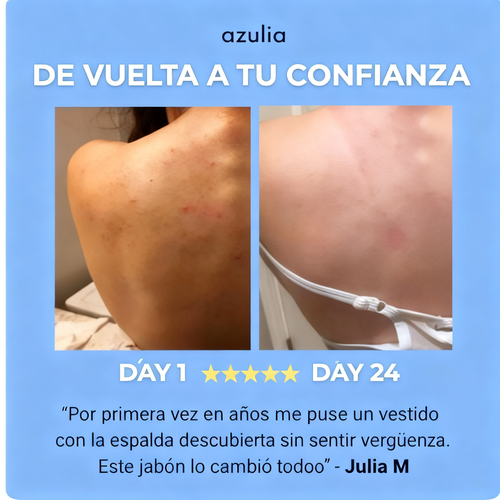 Jabón antiacné Azulia™