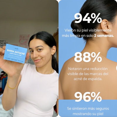 Jabón antiacné Azulia™